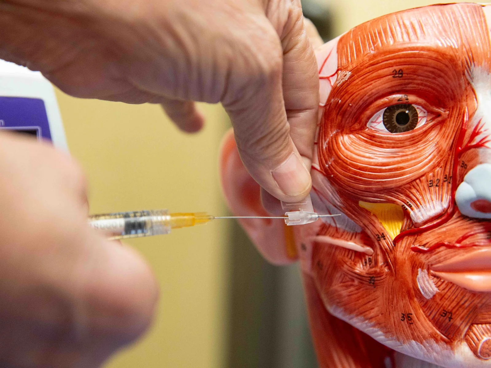Anatomy-guided filler injection demonstrated on a facial muscle model at Reviv Med Spa, Millbrae