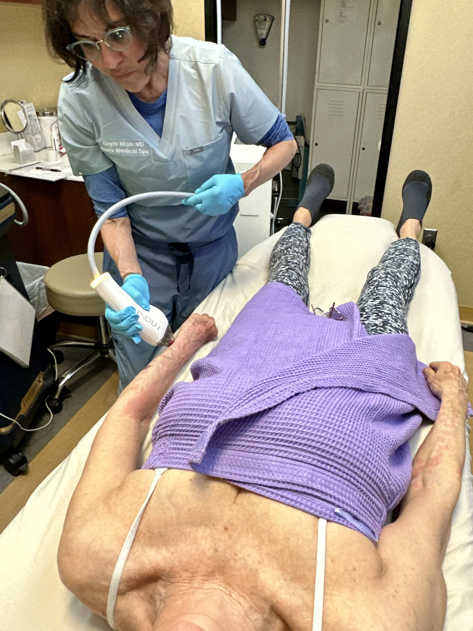 NuEra Tight RF skin-tightening treatment in progress